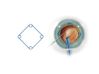 Malyugin Classic Ring 7.00mm Diameter